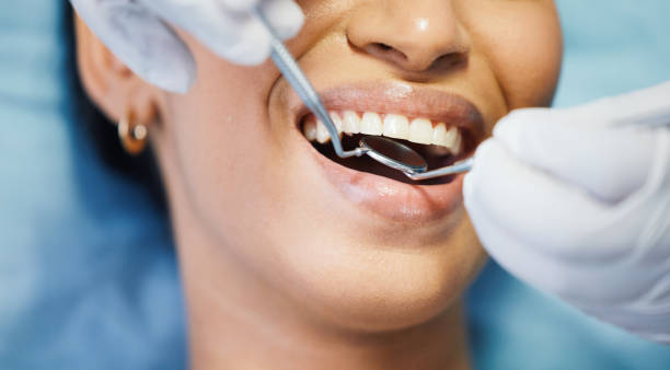 Best Mobile Emergency Dentist in Los Ranchos, CA